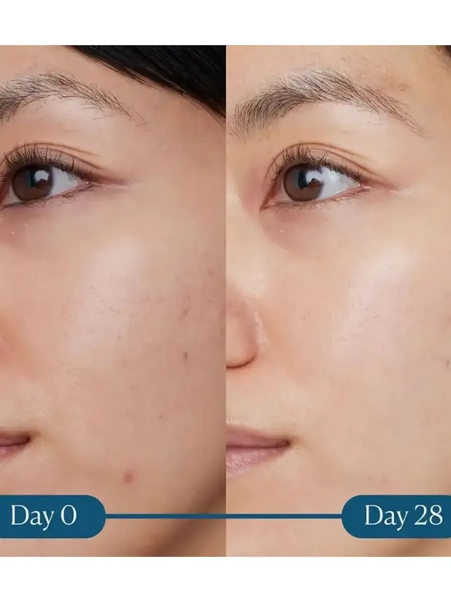 Сыворотка с витамином С Dynamic Super-C Serum 30 мл - 5