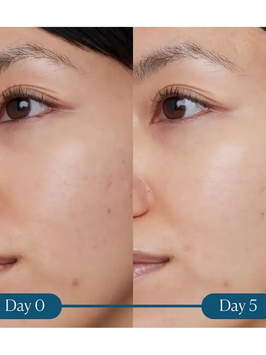 Сыворотка с витамином С Dynamic Super-C Serum 30 мл - 4
