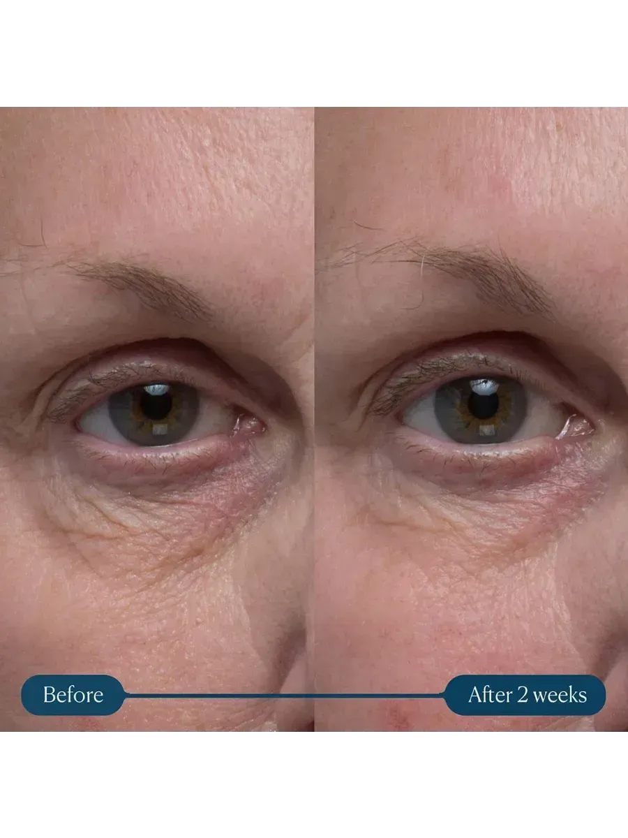 Крем для глаз Pro-Collagen Vitality Eye Cream 15 мл - 3
